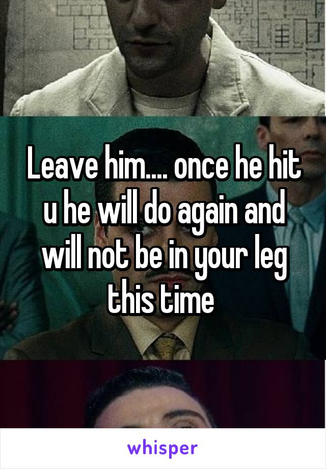 Leave him.... once he hit u he will do again and will not be in your leg this time 