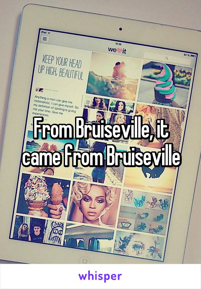 From Bruiseville, it came from Bruiseville