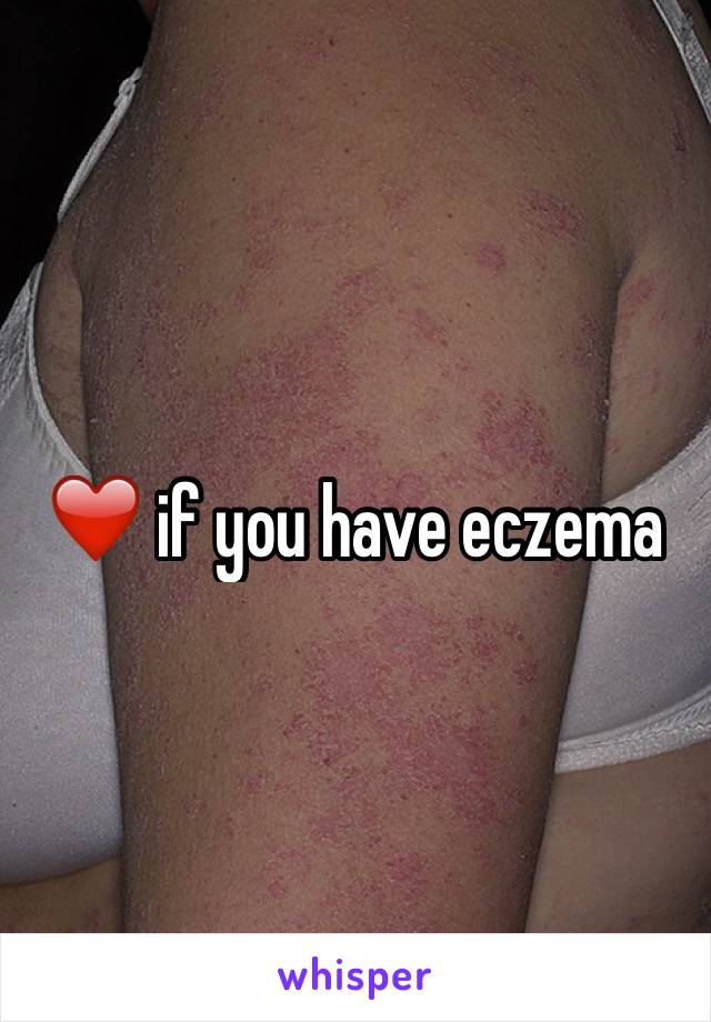 ❤️ if you have eczema