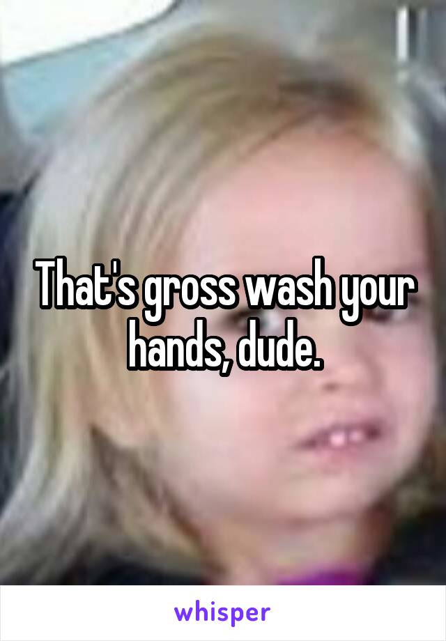 That's gross wash your hands, dude.