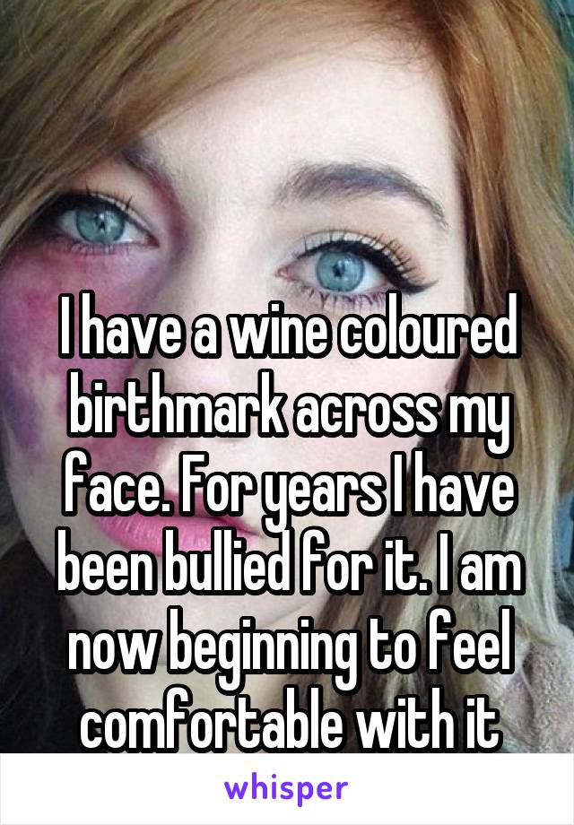 


I have a wine coloured birthmark across my face. For years I have been bullied for it. I am now beginning to feel comfortable with it