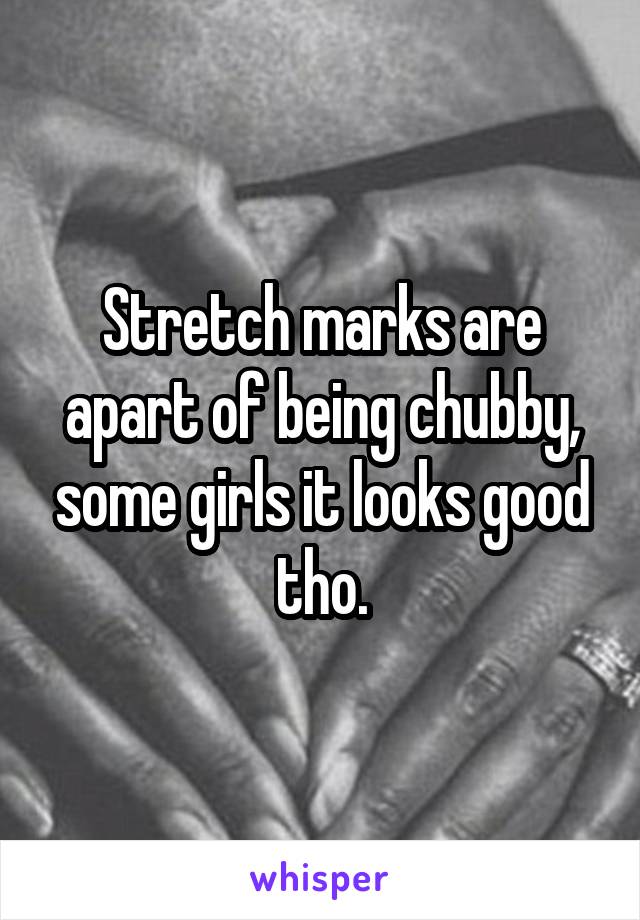 Stretch marks are apart of being chubby, some girls it looks good tho.