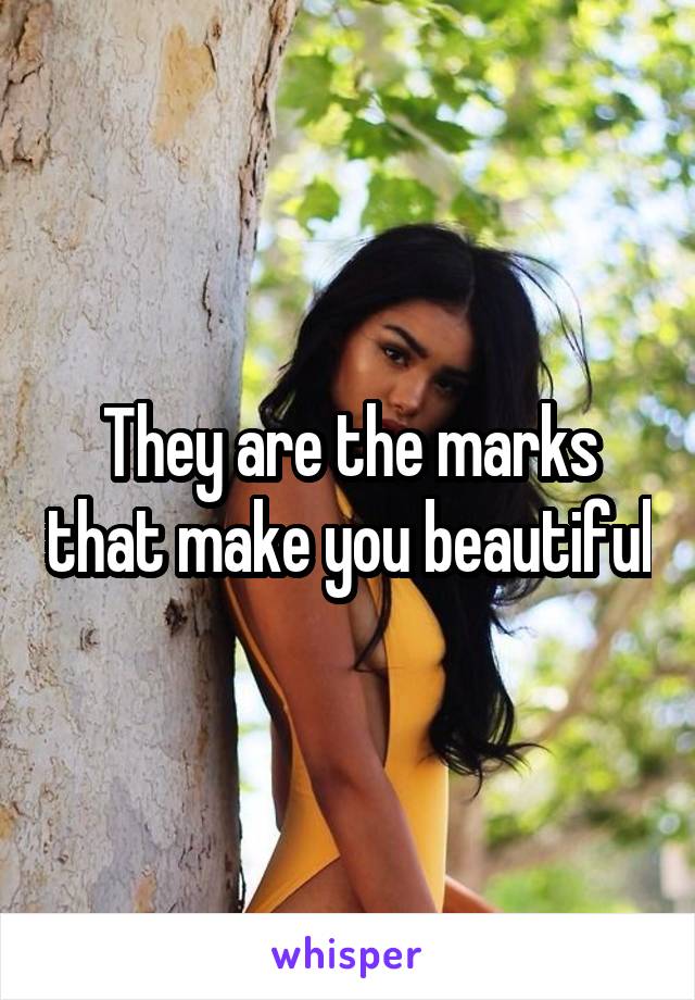 They are the marks that make you beautiful