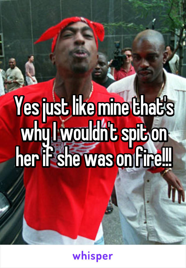 Yes just like mine that's why I wouldn't spit on her if she was on fire!!!