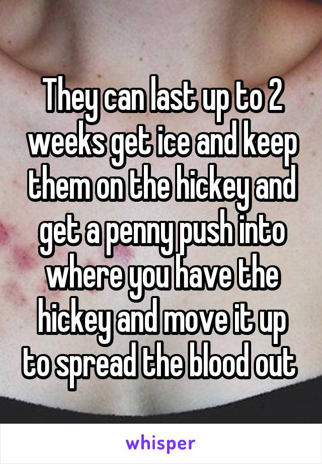 They can last up to 2 weeks get ice and keep them on the hickey and get a penny push into where you have the hickey and move it up to spread the blood out 