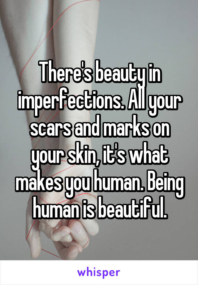 There's beauty in imperfections. All your scars and marks on your skin, it's what makes you human. Being human is beautiful.