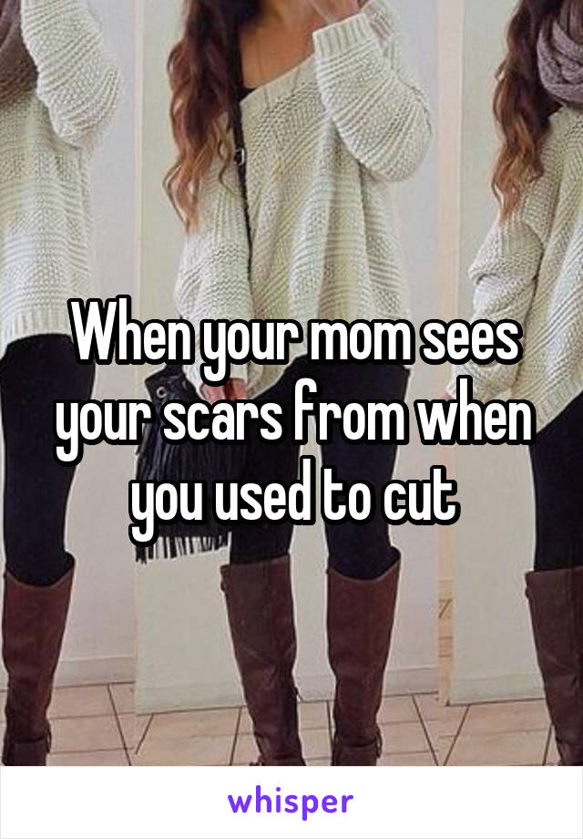 When your mom sees your scars from when you used to cut