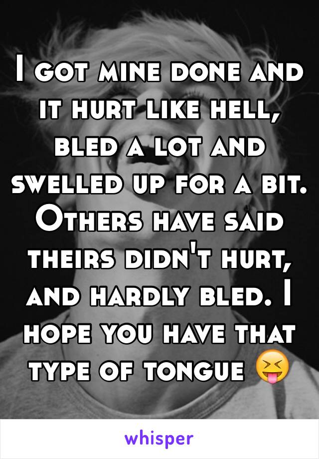 I got mine done and it hurt like hell, bled a lot and swelled up for a bit. 
Others have said theirs didn't hurt, and hardly bled. I hope you have that type of tongue 😝