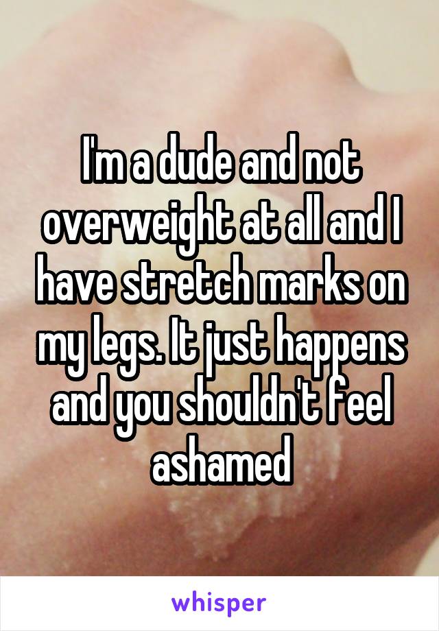 I'm a dude and not overweight at all and I have stretch marks on my legs. It just happens and you shouldn't feel ashamed