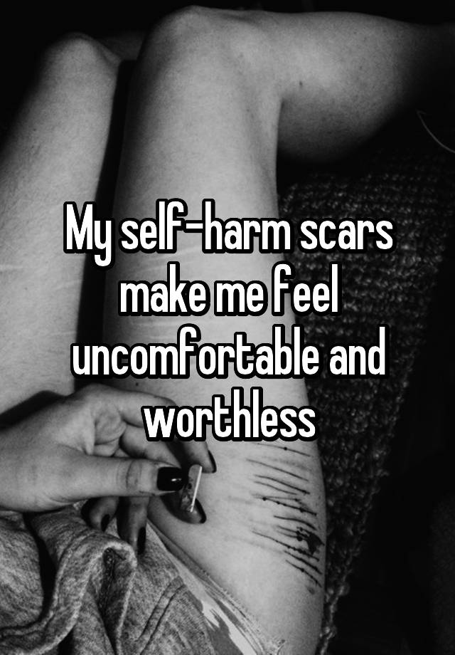 my-self-harm-scars-make-me-feel-uncomfortable-and-worthless