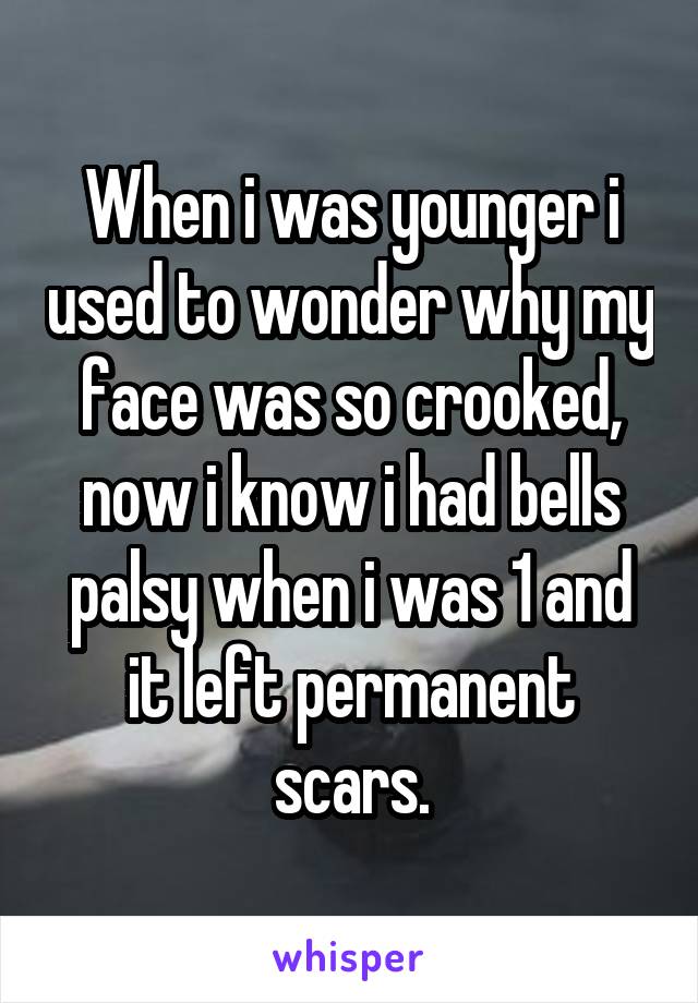 When i was younger i used to wonder why my face was so crooked, now i know i had bells palsy when i was 1 and it left permanent scars.