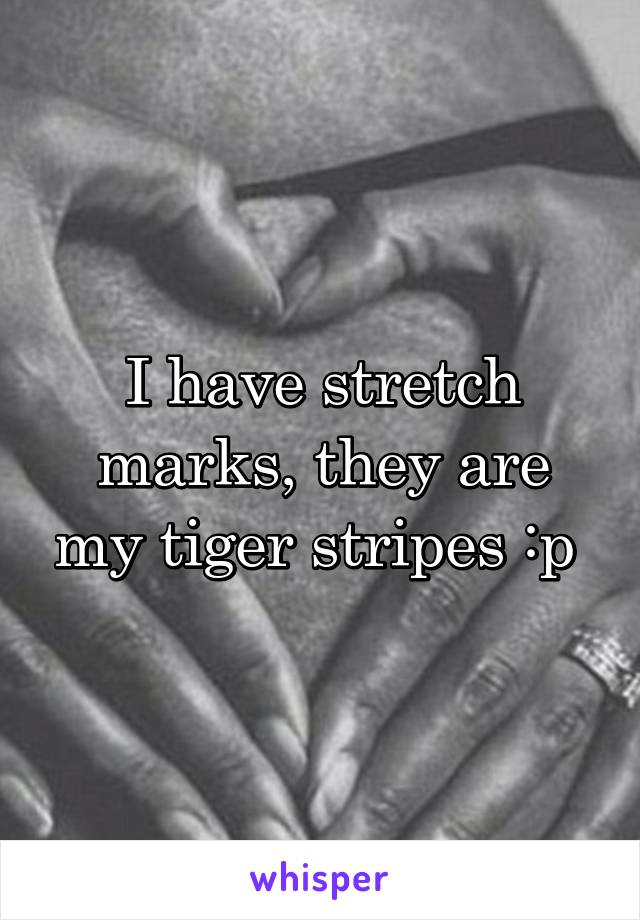 I have stretch marks, they are my tiger stripes :p 