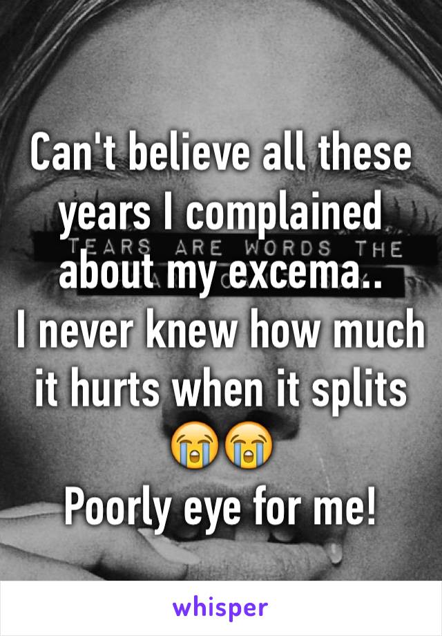 Can't believe all these years I complained about my excema..
I never knew how much it hurts when it splits 😭😭
Poorly eye for me!