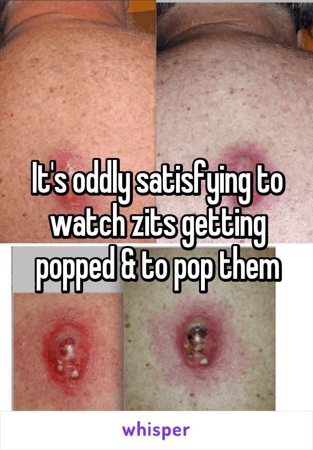 It's oddly satisfying to watch zits getting popped & to pop them