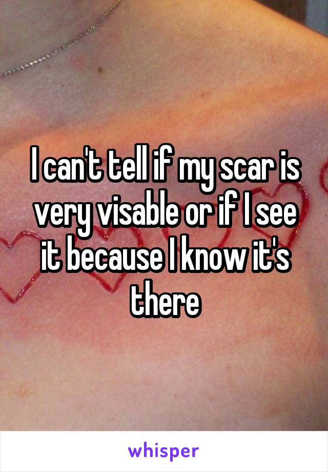 I can't tell if my scar is very visable or if I see it because I know it's there