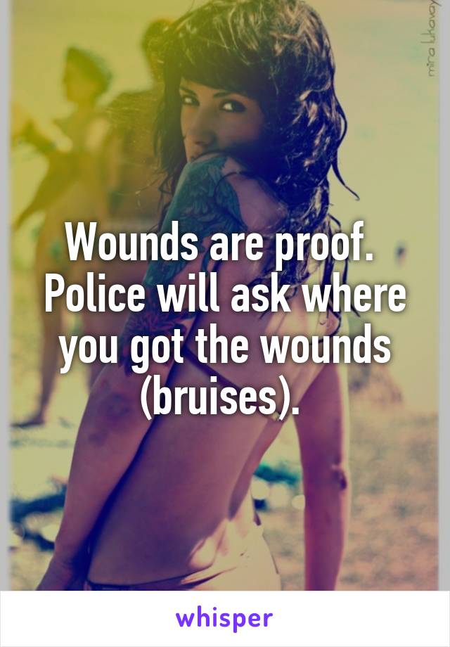 Wounds are proof. 
Police will ask where you got the wounds (bruises). 