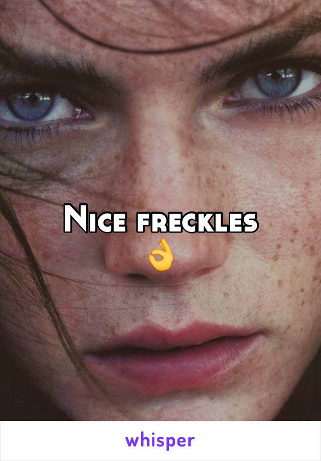 Nice freckles 
👌