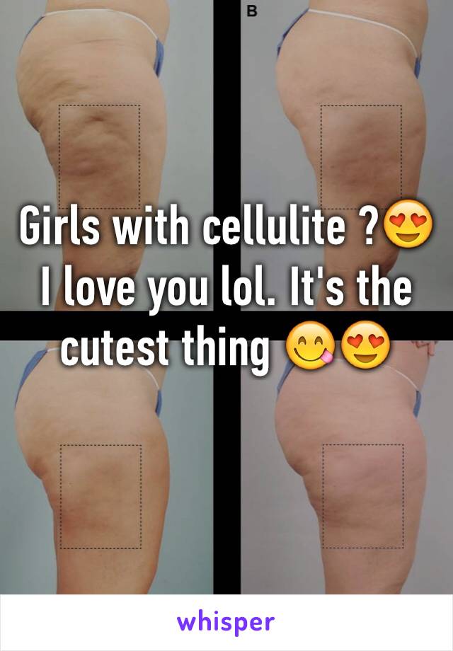 Girls with cellulite ?😍 I love you lol. It's the cutest thing 😋😍