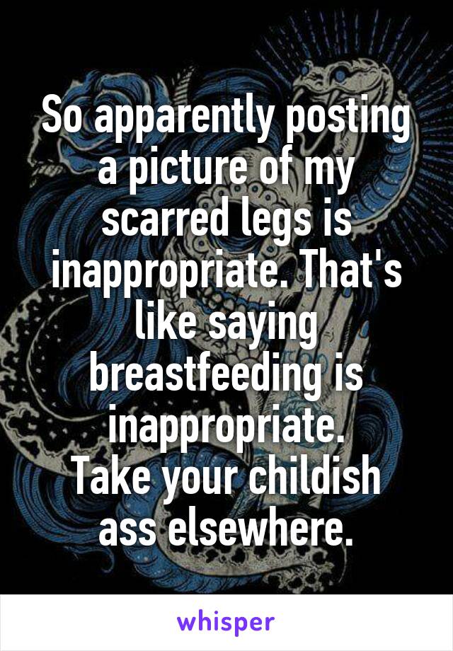 So apparently posting a picture of my scarred legs is inappropriate. That's like saying breastfeeding is inappropriate.
Take your childish ass elsewhere.