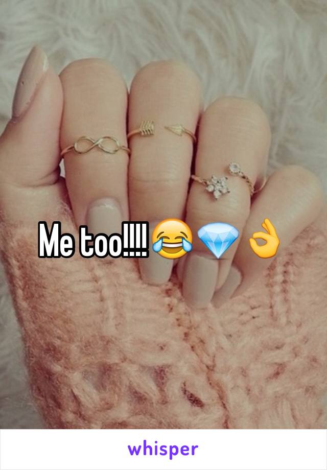 Me too!!!!😂💎👌