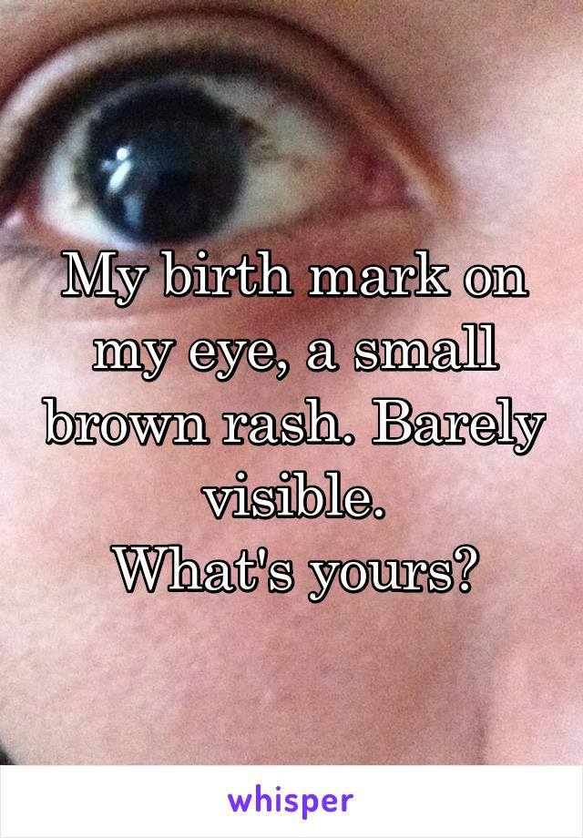 My birth mark on my eye, a small brown rash. Barely visible.
What's yours?