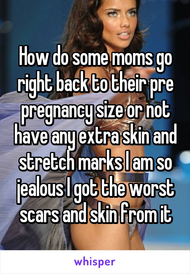 How do some moms go right back to their pre pregnancy size or not have any extra skin and stretch marks I am so jealous I got the worst scars and skin from it