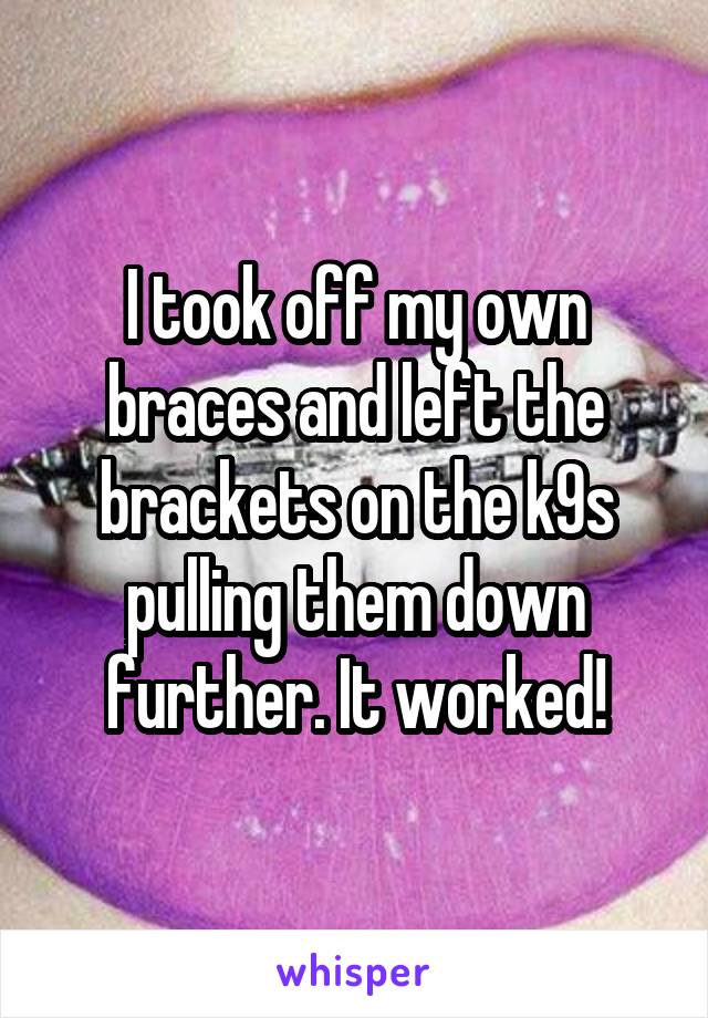 I took off my own braces and left the brackets on the k9s pulling them down further. It worked!