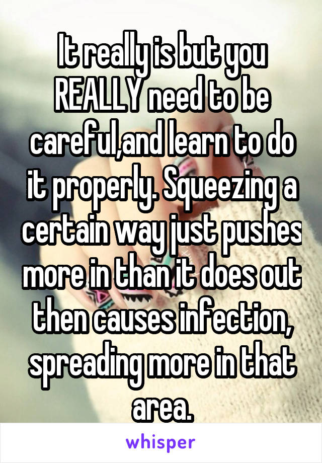 It really is but you REALLY need to be careful,and learn to do it properly. Squeezing a certain way just pushes more in than it does out then causes infection, spreading more in that area.