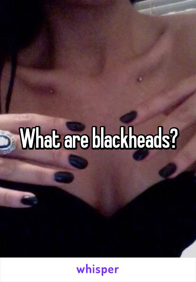 What are blackheads?