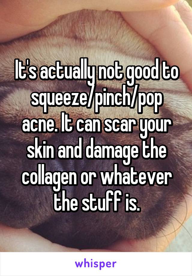 It's actually not good to squeeze/pinch/pop acne. It can scar your skin and damage the collagen or whatever the stuff is.