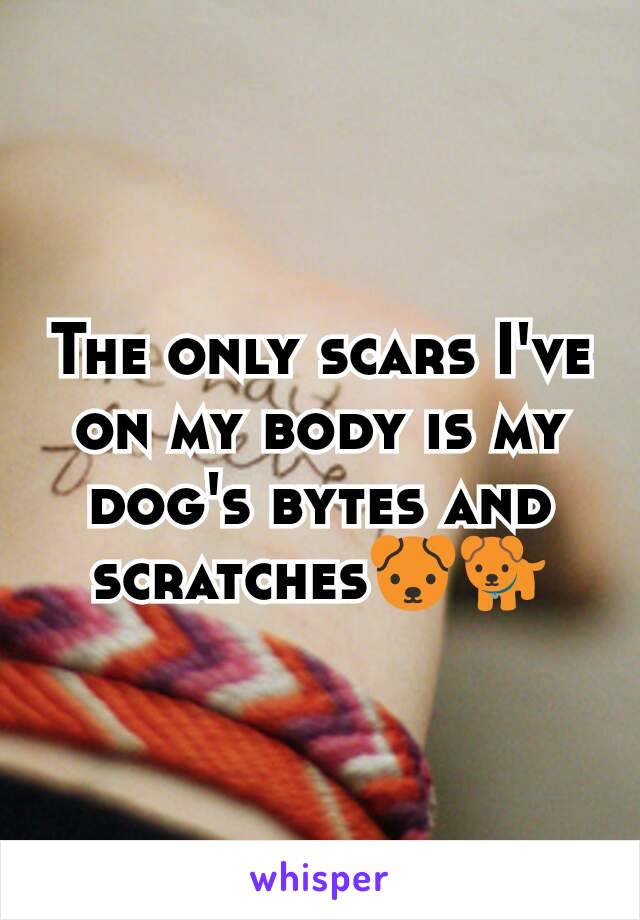 The only scars I've on my body is my dog's bytes and scratches🐶🐕