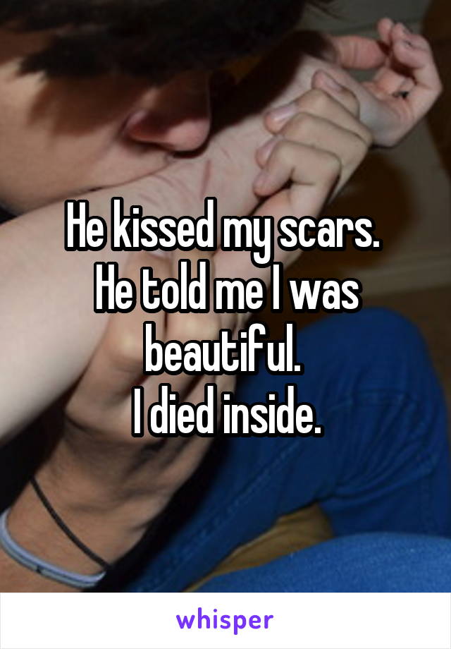 He kissed my scars. 
He told me I was beautiful. 
I died inside.