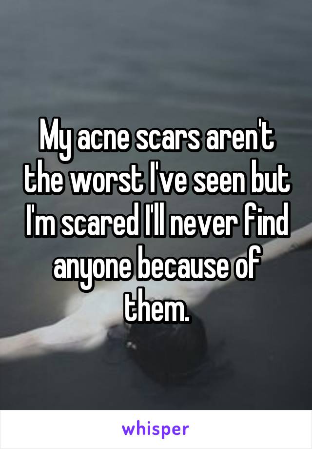 My acne scars aren't the worst I've seen but I'm scared I'll never find anyone because of them.