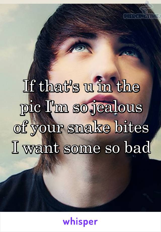 If that's u in the pic I'm so jealous of your snake bites I want some so bad