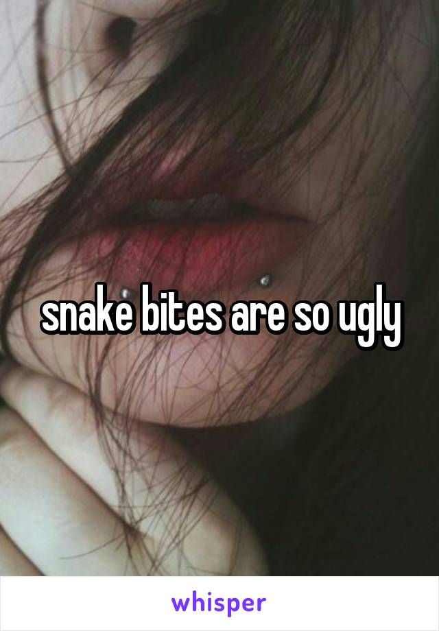 snake bites are so ugly
