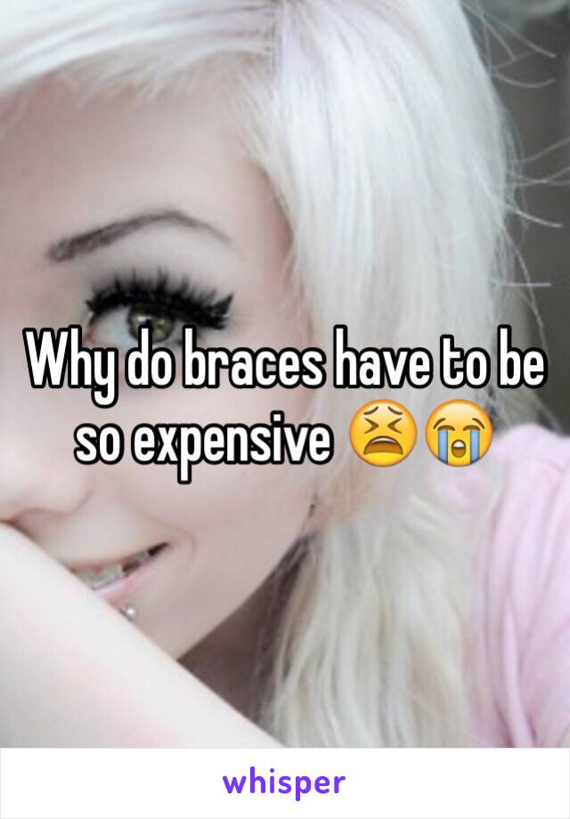 Why do braces have to be so expensive 😫😭