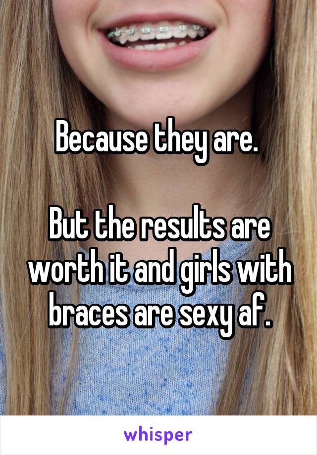 Because they are. 

But the results are worth it and girls with braces are sexy af.