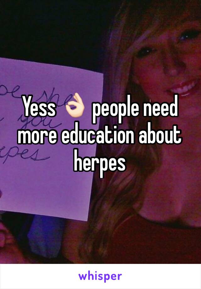 Yess 👌🏻 people need more education about herpes