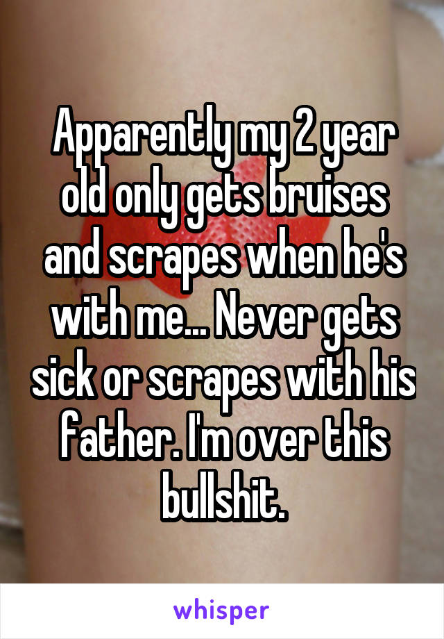 Apparently my 2 year old only gets bruises and scrapes when he's with me... Never gets sick or scrapes with his father. I'm over this bullshit.