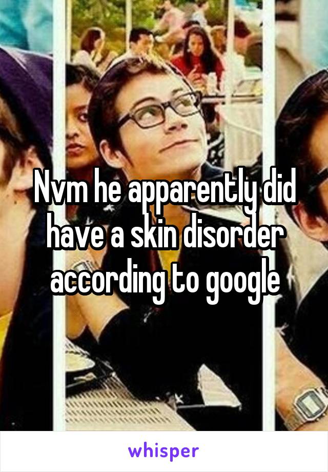 Nvm he apparently did have a skin disorder according to google