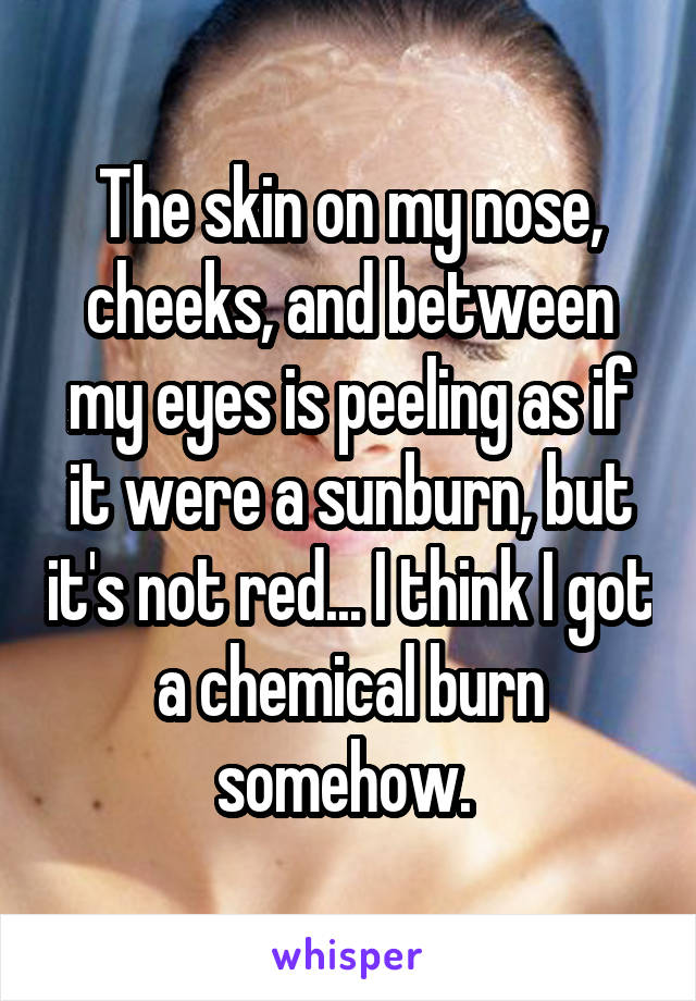 The skin on my nose, cheeks, and between my eyes is peeling as if it were a sunburn, but it's not red... I think I got a chemical burn somehow. 