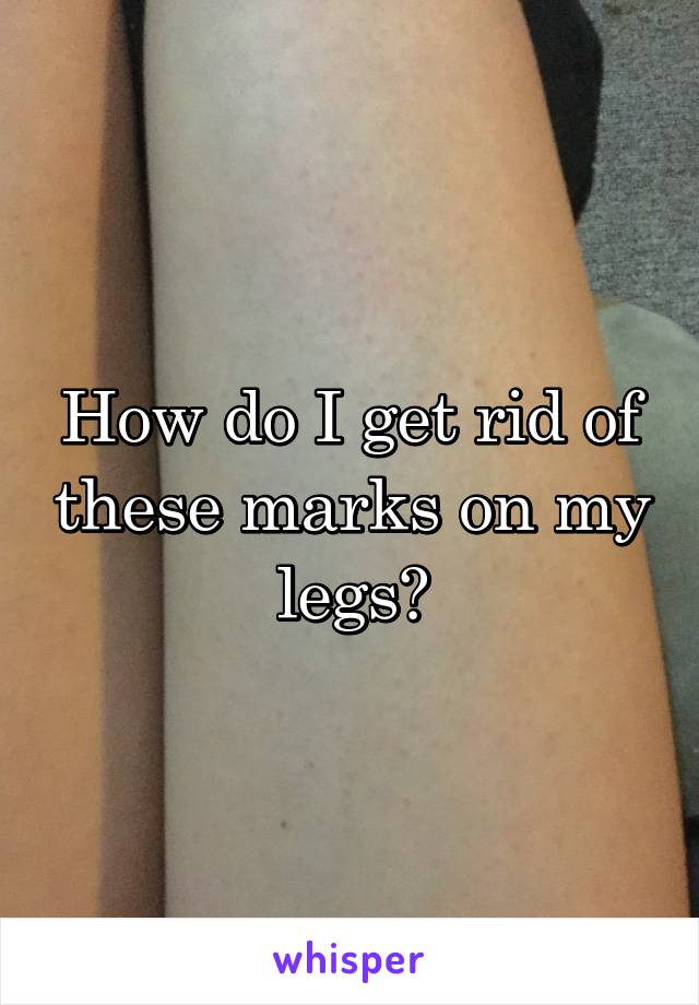 How do I get rid of these marks on my legs?