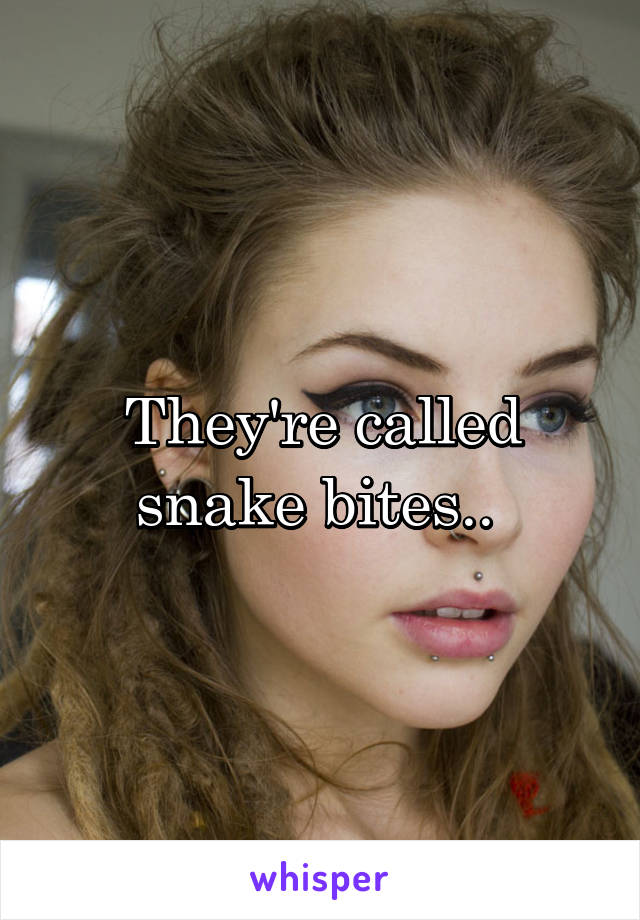 They're called snake bites.. 