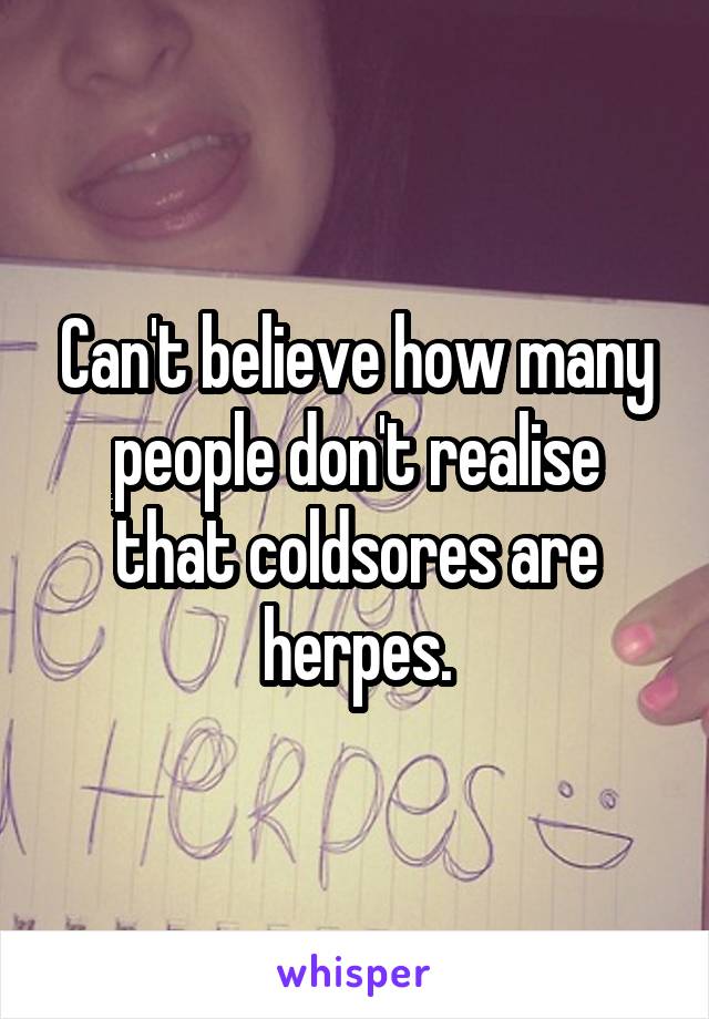 Can't believe how many people don't realise that coldsores are herpes.