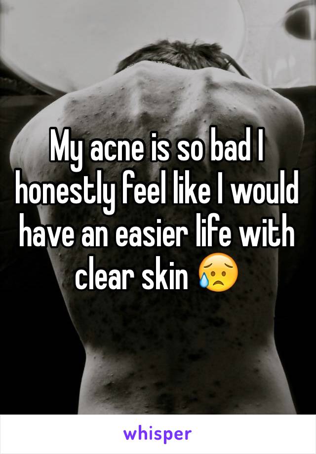 My acne is so bad I honestly feel like I would have an easier life with clear skin 😥
