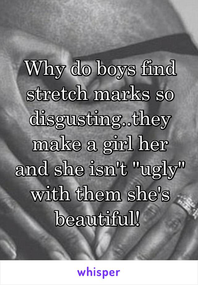 Why do boys find stretch marks so disgusting..they make a girl her and she isn't "ugly" with them she's beautiful! 