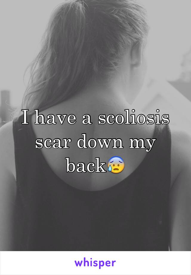 I have a scoliosis scar down my back😰