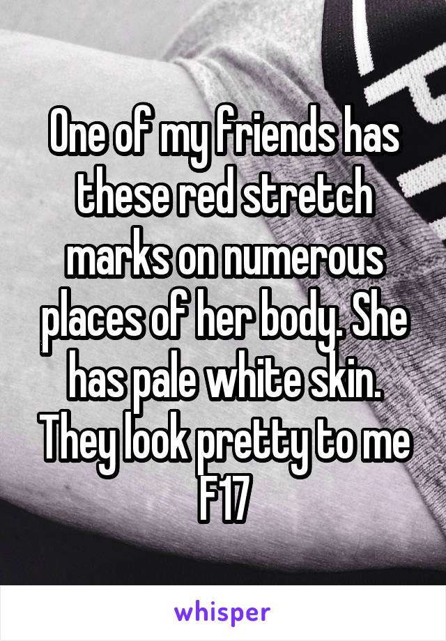 One of my friends has these red stretch marks on numerous places of her body. She has pale white skin. They look pretty to me F17