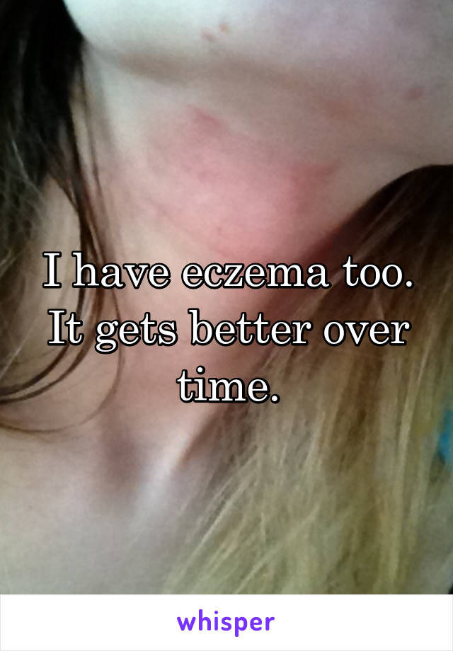 I have eczema too. It gets better over time.