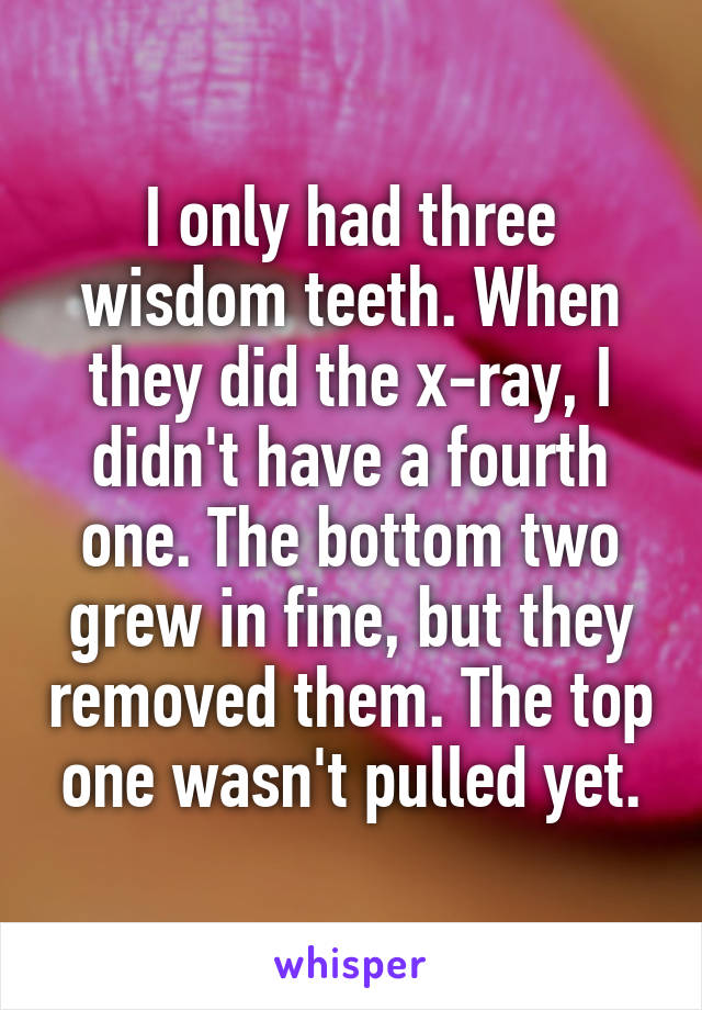 I only had three wisdom teeth. When they did the x-ray, I didn't have a fourth one. The bottom two grew in fine, but they removed them. The top one wasn't pulled yet.